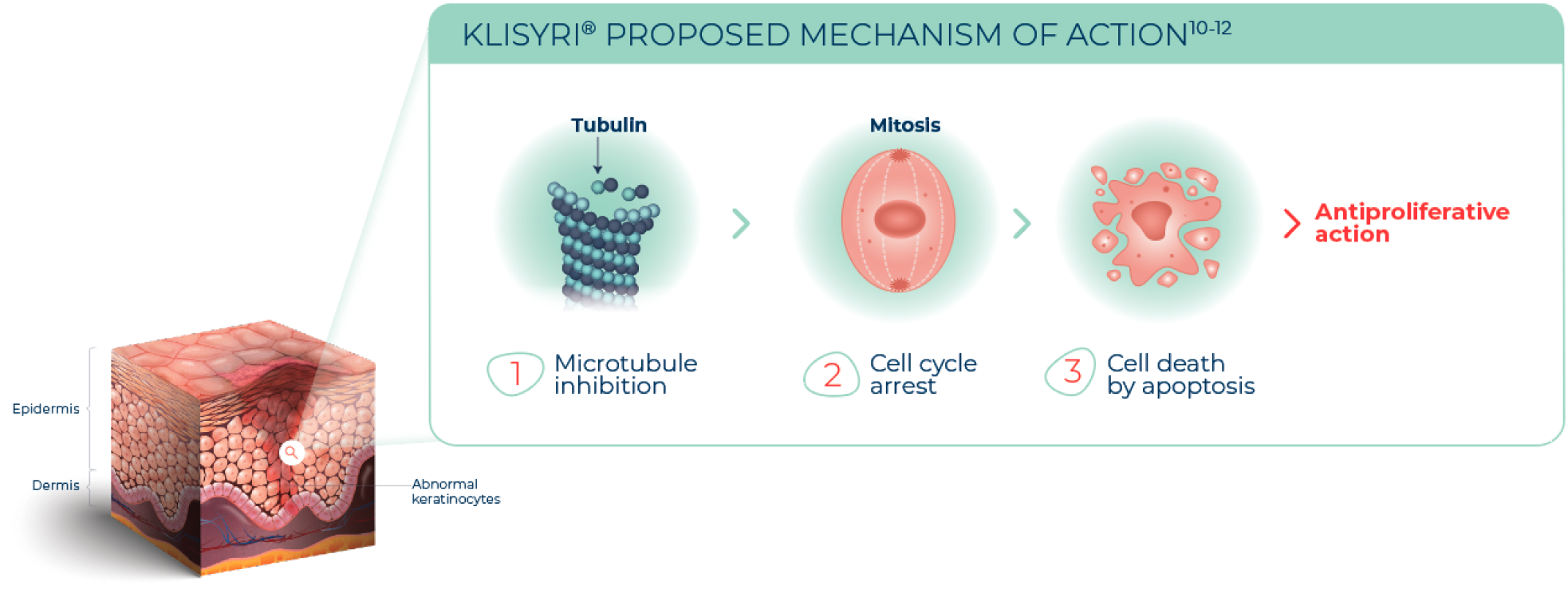 mechanism