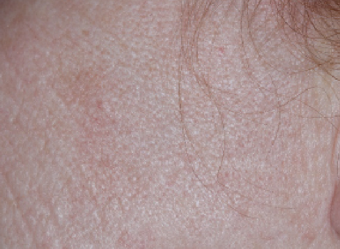 skin image on day fifty seven