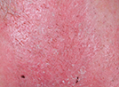 skin image on day eight